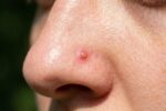 7 Proven Home Remedies